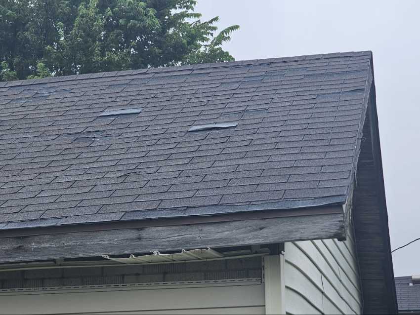 Shingles